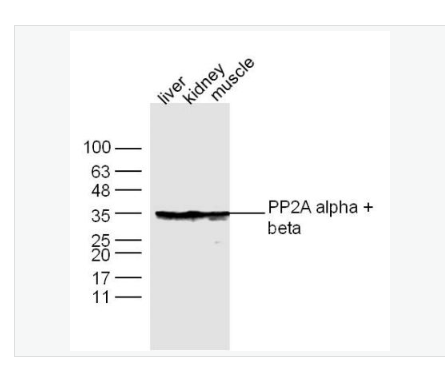 Anti-PP2A alpha + beta antibody-蛋白質(zhì)磷酸酶-2A抗體,PP2A alpha + beta