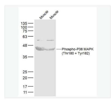 Anti-Phospho-P38 MAPK-磷酸化-丝裂原活化蛋白激酶p38抗体,Phospho-P38 MAPK (Thr180 + Tyr182)