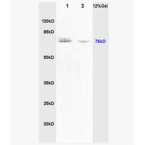 Anti-CRF antibody-蓬乱蛋白1抗体,DVL1