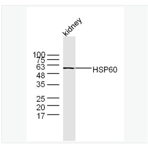 Anti-HSP60 antibody-热休克蛋白-60/groEL抗体