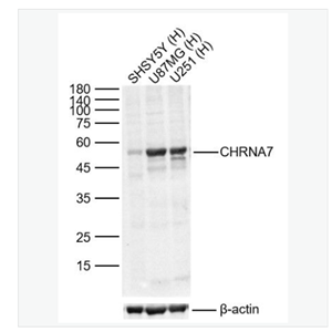 Anti-CHRNA7 antibody-烟碱型乙酰胆碱受体α7抗体