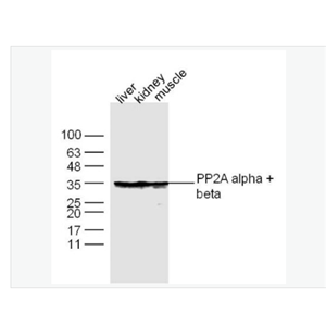 Anti-PP2A alpha + beta antibody-蛋白质磷酸酶-2A抗体