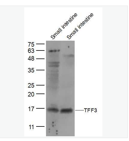 Anti-TFF3 antibody-三叶肽因子3抗体,TFF3