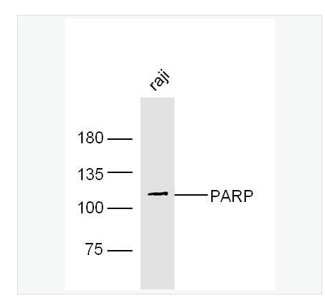 Anti-PARP1 antibody-多腺苷二磷酸多聚酶抗体(N端),PARP1