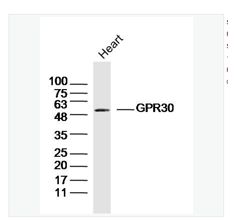 Anti-GPR30 antibody -G蛋白偶联受体30抗体,GPR30