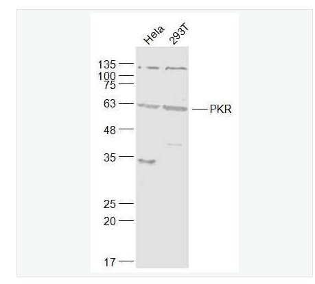 Anti-EIF2AK2 (PKR) antibody   -干扰素诱导的双链RNA活化蛋白激酶抗体,EIF2AK2 (PKR)