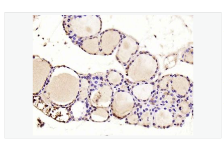 Anti-PTEN antibody -PTEN抗体,PTEN