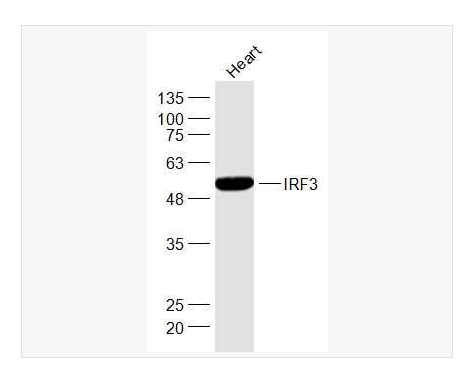 Anti-IRF3 antibody-干扰素调节因子3,IRF3