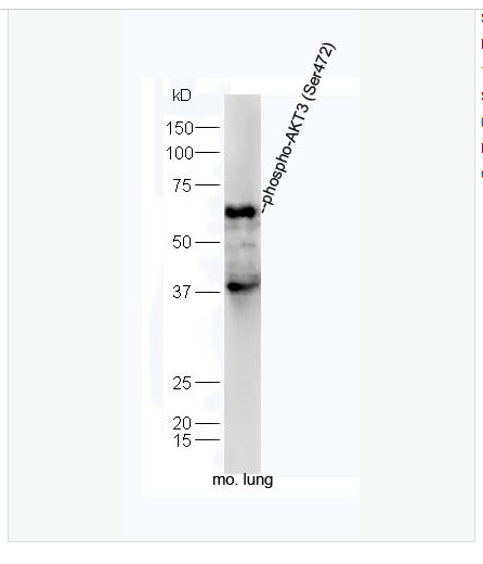 Anti-phospho-AKT3-磷酸化蛋白激酶AKT3抗体,phospho-AKT3 (Ser472)