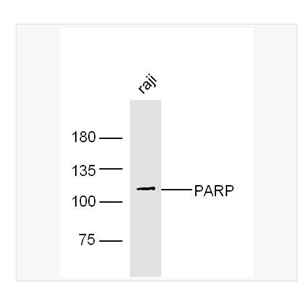 Anti-PARP1 antibody-多腺苷二磷酸多聚酶抗体(N端)