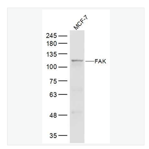 Anti-FAK antibody -粘着斑激酶抗体