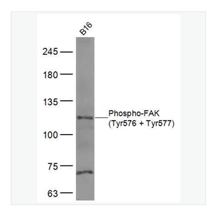 Anti-Phospho-FAK antibody -磷酸化粘着斑激酶抗体,Phospho-FAK (Tyr576 + Tyr577)