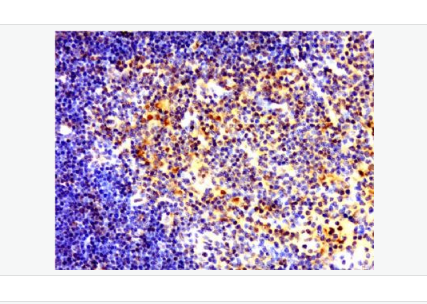 Anti-NFKB p65 antibody  -细胞核因子/k基因结合核因子抗体,NFKB p65