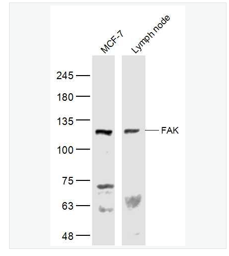 Anti-FAK antibody  -粘着斑激酶抗体,FAK
