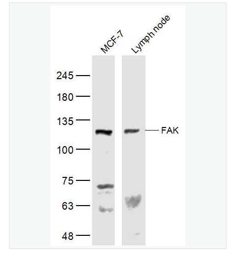 Anti-FAK antibody  -粘著斑激酶抗體,FAK