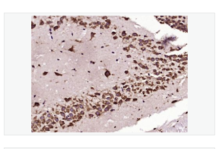 Anti-TGF beta 1 antibody -转化生长因子β1/TGF β1/TGF-β1单克隆抗体,TGF beta 1