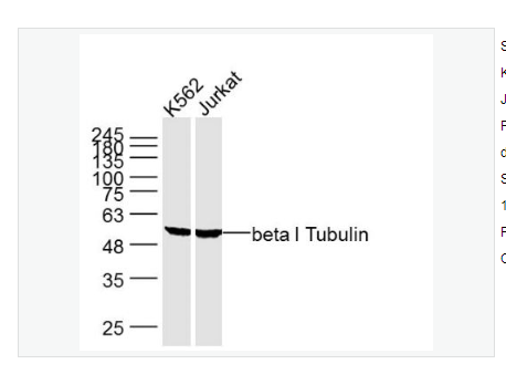 Anti-beta I Tubulin -微管蛋白β1單克隆抗體,beta I Tubulin (Loading Control)