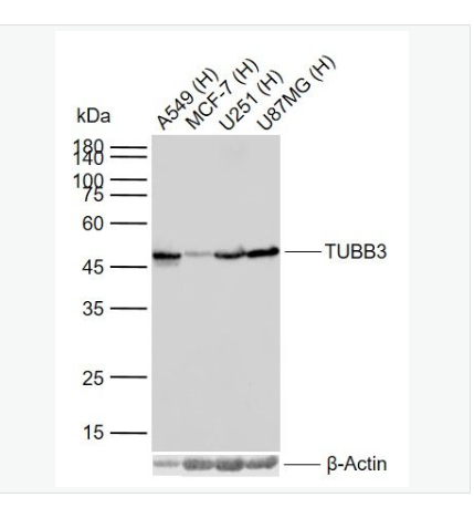 Anti-TUBB3 antibody-微管蛋白β3单克隆抗体,TUBB3 (Neuronal Marker)