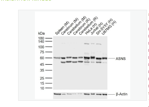 Anti-ASNS antibody -天冬酰胺合成酶,ASNS