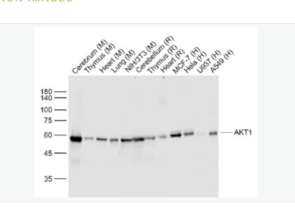 Anti-AKT1 antibody -蛋白激酶B重组兔单克隆抗体,AKT1