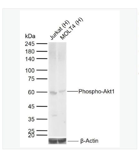 Anti-Phospho-Akt1  antibody -磷酸化Akt1重组兔单克隆抗体,Phospho-Akt1 (Ser473)