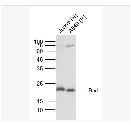 Anti-Bad antibody -相关死亡促进因子Bad重组兔单克隆抗体,Bad