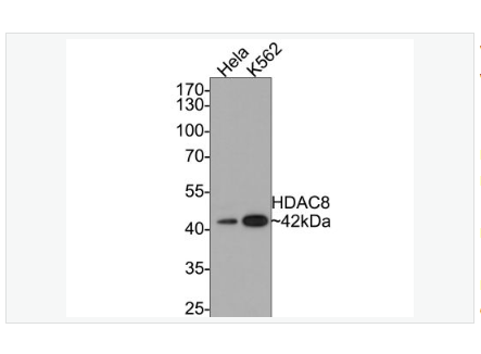 Anti-HDAC8 antibody -组蛋白去乙酰化酶8重组兔单克隆抗体,HDAC8