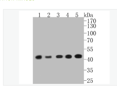 Anti-alpha smooth muscle Actin antibody-α-SMA重组兔单克隆抗体,alpha smooth muscle Actin