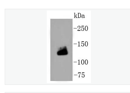 Anti-Collagen I antibody-I型膠原重組兔單克隆抗體,Collagen I