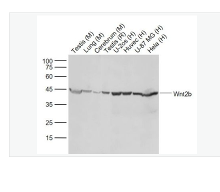 Anti-Wnt2b antibody-信號通路Wnt2B重組兔單克隆抗體,Wnt2b