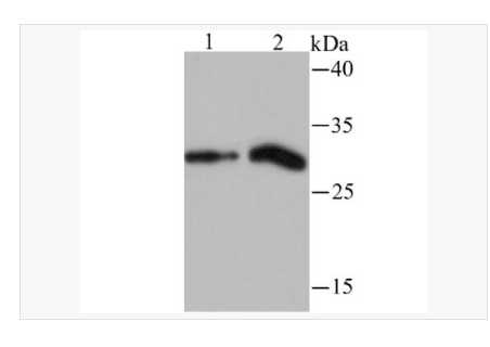Anti-Histone H1.2  antibody-组蛋白H1.2重组兔单克隆抗体,Histone H1.2