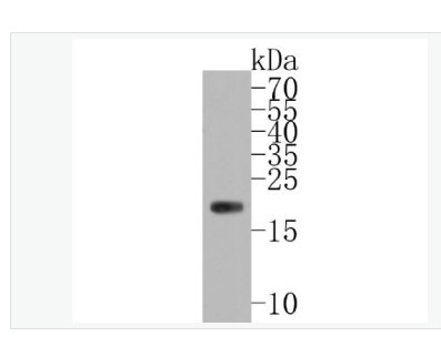 Anti-Ferritin Heavy Chain antibody-鐵蛋白重組兔單克隆抗體,Ferritin Heavy Chain