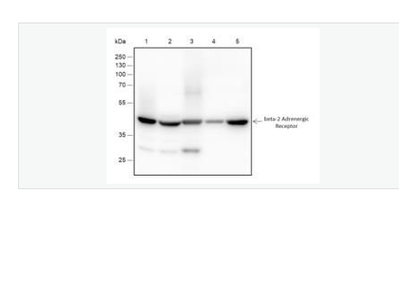 Anti-ADRB2 antibody-肾上腺素能受体β2重组兔单克隆抗体,ADRB2