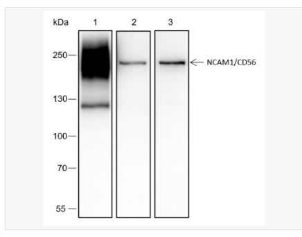 Anti-NCAM antibody-神经细胞粘附分子1重组兔单克隆抗体,NCAM