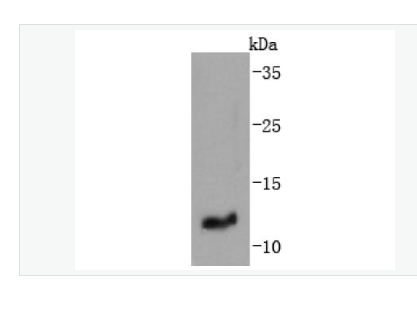 Anti-IGF2 antibody -胰岛素样生长因子-II重组兔单克隆抗体,IGF2