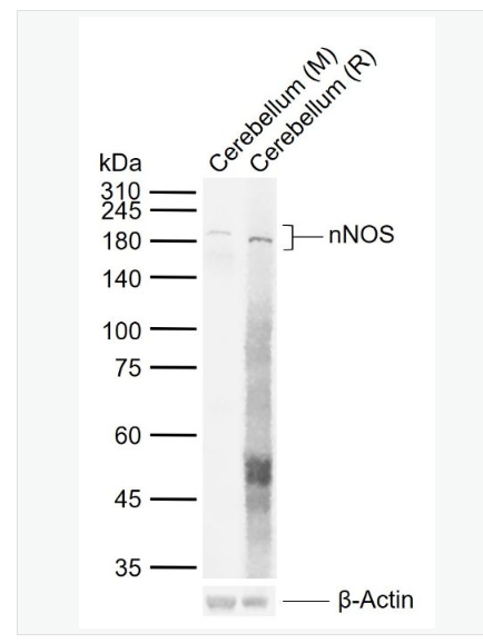 Anti-nNOS antibody-一氧化氮合成酶-1（神经型）重组兔单克隆抗体,nNOS