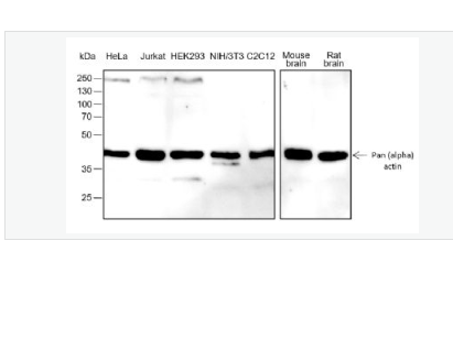 Anti-Pan Actin antibody -泛肌动蛋白重组兔单抗,Pan Actin