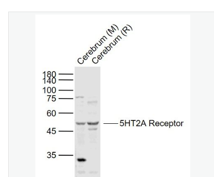 Anti-5HT2A Receptor antibody-5-羟色胺受体2A抗体,5HT2A Receptor