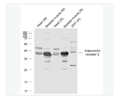 Anti-Adiponectin receptor 2 antibody-脂联素受体2抗体,Adiponectin receptor 2