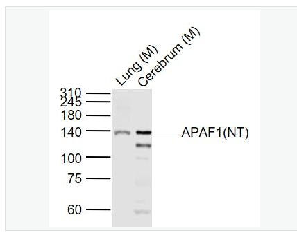 Anti-APAF1(NT) antibody-凋亡蛋白活性因子-1抗体（N端）,APAF1(NT)