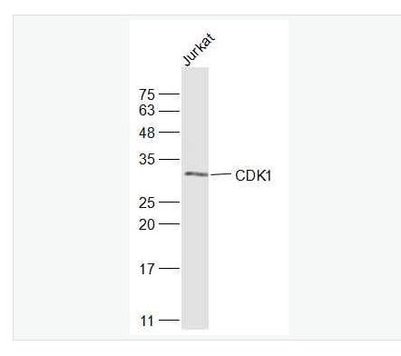 Anti-CDK1 antibody-周期素依赖性激酶1抗体,CDK1