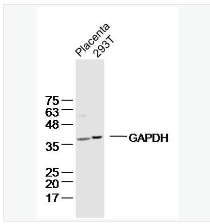 Anti-GAPDH antibody-3-磷酸甘油醛脱氢酶(内参)单克隆抗体,GAPDH (Loading Control)