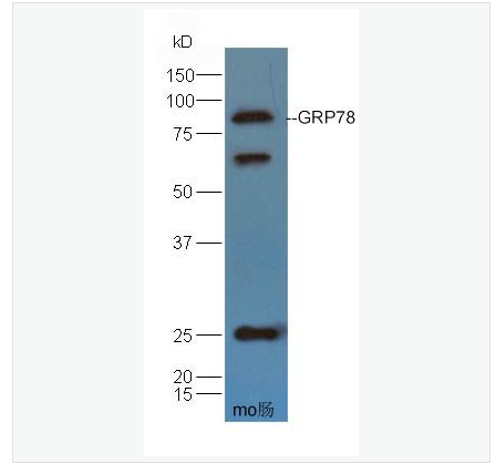 Anti-GRP78 antibody-葡萄糖调节蛋白78/热休克蛋白70蛋白5抗体,GRP78