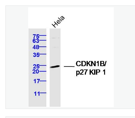Anti-CDKN1B/p27 KIP 1 antibody-P27抗体/周期素依赖激酶抑制剂,CDKN1B/p27 KIP 1
