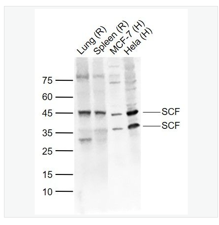 Anti-SCF antibody-干细胞生长因子抗体,SCF