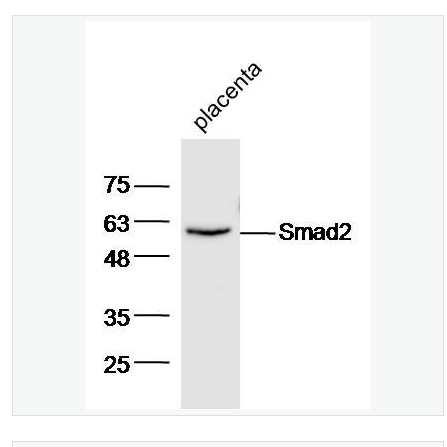 Anti-Smad2 antibody-細(xì)胞信號轉(zhuǎn)導(dǎo)分子Smad-2抗體,Smad2