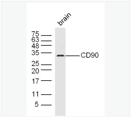 Anti-CD90/Thy-1 antibody-CD90抗體,CD90/Thy-1