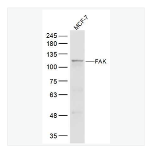 Anti-FAK antibody-粘着斑激酶抗体,FAK