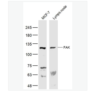 Anti-FAK antibody  -粘着斑激酶抗体
