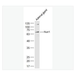 Anti-Nurr1 antibody  -核受體相關(guān)因子-1抗體